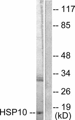 All lanes : Anti-Cpn10 antibody (ab53106) at 1/300 dilutionLane 1 : NIH/3T3 cell extractLane 2 : NIH/3T3 cell extract with immunising peptide