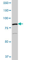 Anti-Factor XIIIa antibody (ab88905) at 1/500 dilution + Human pancreas tissue lysate at 50 µg