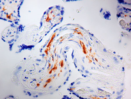 Immunohistochemical analysis of formalin-fixed, paraffin-embedded Human placenta tissue, staining Factor XIIIa with ab1834.