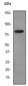 Anti-Factor XIIIa antibody [EP3372] (ab76105) at 1/100000 dilution + PMBC cell lysate at 10 µgSecondaryHRP labelled goat anti-rabbit at 1/2000 dilution