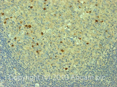 IHC image of ab24533 staining in human normal lymph node formalin fixed paraffin embedded tissue section, performed on a Leica BondTM system using the standard protocol F. The section was pre-treated using heat mediated antigen retrieval with sodium citrate buffer (pH6, epitope retrieval solution 1) for 20 mins. The section was then incubated with ab24533, 5µg/ml, for 15 mins at room temperature and detected using an HRP conjugated compact polymer system. DAB was used as the chromogen. The section was then counterstained with haematoxylin and mounted with DPX.For other IHC staining systems (automated and non-automated) customers should optimize variable parameters such as antigen retrieval conditions, primary antibody concentration and antibody incubation times.