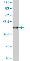 Western blot against tagged recombinant protein immunogen using ab55425 FADS3 antibody at 1ug/ml.