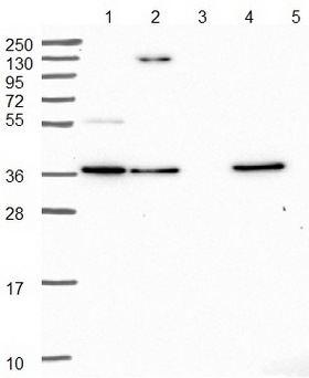 All lanes : Anti-FAM105B antibody (ab151117) at 1/100 dilutionLane 1 : RT 4 cell lysateLane 2 : U 251 MG cell lysateLane 3 : Human plasma lysateLane 4 : Human liver tissue lysateLane 5 : Human tonsil tissue lysate