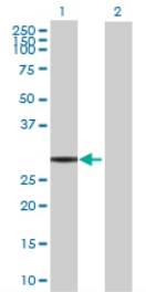 All lanes : Anti-FAM108B1 antibody (ab68751) at 1/500 dilutionLane 1 : FAM108B1 transfected 293T cell lysateLane 2 : Non-transfected 293T cell lysateLysates/proteins at 25 µg per lane.SecondaryGoat Anti-Mouse IgG (H&L)-HRP Conjugate at 1/2500 dilution
