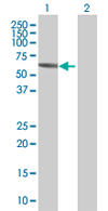 All lanes : Anti-CPNE3 antibody (ab67575) at 1/500 dilutionLane 1 : CPNE3 transfected 293T cell lysateLane 2 : Non-transfected 293T cell lysateLysates/proteins at 25 µg per lane.SecondaryGoat Anti-Mouse IgG (H&L)-HRP Conjugate at 1/2500 dilution