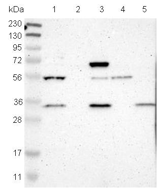 All lanes : Anti-FAM49B antibody (ab121299) at 1/250 dilutionLane 1 : RT4 cell lysateLane 2 : Human Plasma lysateLane 3 : U-251 MG cell lysateLane 4 : Human Liver lysateLane 5 : Human Tonsil lysatedeveloped using the ECL technique