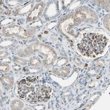 ab121299 at 1/100 dilution staining FAM49B in Paraffin-emebedded Human kidney tissue by Immunohistochemistry.