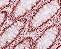 Immunohistochemical analysis of paraffin-embedded Human colon tissue labeling FAM50A with ab186410 at 1/500 and ready to use HRP Polymer for Rabbit IgG. Counterstained with Hematoxylin.