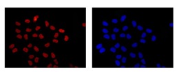 Immunocytochemical analysis of Hela cells fixed in 4% paraformaldehyde labling FAM50A with ab186410 at 1/500 dilution and Goat anti rabbit IgG(Alexa Fluor® 555) at 1/200 dilution