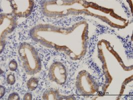 CPS1 antibody (ab54586) used in immunohistochemistry at 3ug/ml on formalin fixed and paraffin embedded human small Intestine.