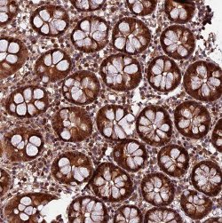 ab122799, at 1/50 dilution, staining FAM71C in Paraffin-embedded Human colon tissue by Immunohistochemistry