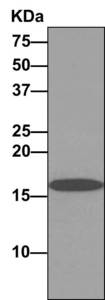 Western blot analysis on immunoprecipitation pellet from HeLa cell lysate using ab166607 and HRP-conjugated anti-rabbit IgG, which preferentially detects the non-reduced form of rabbit IgG.