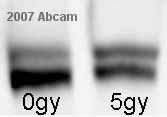 Samples were immunoprecipitated with ab5360 (4ug antibody/1mg cell lysate) FANCD2-S and -L were clearly seen in the figure. Left lane is non-irradiated samples while right lane is sample irradiated with 5 Gray (Gy) ionizing irradiation. FANCD2-L is seen in non-irradiated sample due to S-phase progression.See Abreview