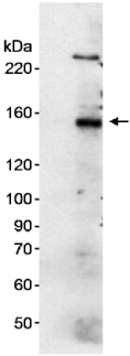 All lanes : Anti-FANCI antibody (ab15344) at 1/5000 dilutionLane 1 : HeLa cell nuclear extract 5 µg.Lane 2 : HeLa cell nuclear extract 20 µg.Observed band size : 145 kDa (why is the actual band size different from the predicted?)Additional bands at : 160 kDa,230 kDa,70 kDa. We are unsure as to the identity of these extra bands.Exposure time :  15 minutesDetection: chemiluminescence.