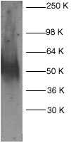 ab2437 at a 1:200 dilution staining Fas in Jurkat whole cell lysate ab2437 at a 1:200 dilution staining Fas in Jurkat whole cell lysate 