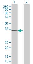 All lanes : Anti-CNTD antibody (ab67406) at 1/500 dilutionLane 1 : CNTD transfected 293T lysateLane 2 : Non-transfected 293T lysateLysates/proteins at 25 µg per lane.SecondaryGoat anti-mouse IgG (H&L)-HRP conjugate at 1/2500 dilution