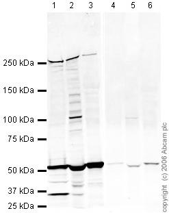 All lanes : Anti-Fatty Acid Synthase antibody (ab22759) at 1 µg/mlLane 1 : 3T3-L1 (Mouse embryonic fibroblast - adipose like cell line) Nuclear Lysate (ab14632)Lane 2 : Brain (Mouse) Tissue Lysate (ab27253)Lane 3 : Liver (Mouse) Tissue Lysate (ab7935)Lane 4 : 3T3-L1 (Mouse embryonic fibroblast - adipose like cell line) Nuclear Lysate (ab14632) with Mouse Fatty Acid Synthase peptide (ab25719) at 1 µg/mlLane 5 : Brain (Mouse) Tissue Lysate (ab27253) with Mouse Fatty Acid Synthase peptide (ab25719) at 1 µg/mlLane 6 : Liver (Mouse) Tissue Lysate (ab7935) with Mouse Fatty Acid Synthase peptide (ab25719) at 1 µg/mlLysates/proteins at 20 µg per lane.SecondaryAlexa Fluor Goat polyclonal to Rabbit IgG (700) at 1/10000 dilutionPerformed under reducing conditions.