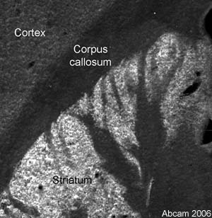 Immunofluorescent staining for Fatty Acid Synthase in the rat striatum using Rabbit polyclonal to Fatty Acid Synthase (ab22759). Abundant staining was observed in the Striatum with lower levels of staining observed in the Corpus callosum. This is a montage of three pictures aquired using a X10 objective. ab22759 was used at 1/200 (2µg/ml) incubated overnight at room temperature.Secondary antibody used was anti-rabbit Alexa Fluor 488 at 1/1000 incubated for 2 hours at room temperature. Rat brain tissue was perfusion fixed with 4% PFA followed by overnight post-fixation in the same fixative, cryoprotected in 20% sucrose and frozen in OCT. 30µm coronal sections were cut on a cyrostat and immunohistochemistry performed by the 'free floating' technique.