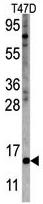 Anti-FAU antibody (ab63066) at 1/250 dilution + T47D cell lysate at 12.5 µg