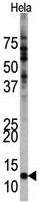 Anti-FAU antibody (ab63066) at 1/250 dilution + HeLa cell lysate at 12.5 µg