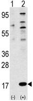 All lanes : Anti-FAU antibody (ab63063) at 1/100 dilutionLane 1 : 293 cell lysate, nontransfectedLane 2 : 293 cell lysate, transiently transfected with the FAU geneLysates/proteins at 2 µg per lane.