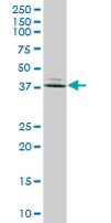 Anti-FBP1 antibody (ab67247) at 1/500 dilution + human stomach tissue lysate at 25 µg/mlSecondaryGoat Anti-Mouse IgG (H&L)-HRP Conjugate at 1/2500 dilution