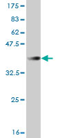 Western blot against tagged recombinant protein immunogen using ab57306 FBXL3 antibody at 1ug/ml.