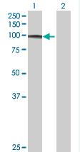 All lanes : Anti-FBXO34 antibody (ab67953) at 1/500 dilutionLane 1 : FBXO34 transfected 293T cell lysateLane 2 : Non transfected 293T cell lysateLysates/proteins at 25 µg per lane.SecondaryGoat Anti-Mouse IgG (H&L)-HRP Conjugate at 1/2500 dilution