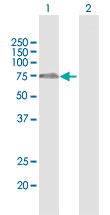 All lanes : Anti-FBXO7 antibody (ab167278) at 1 µg/mlLane 1 : FBXO7 transfected 293T cell lysateLane 2 : Non-transfected lysateLysates/proteins at 15 µl per lane.developed using the ECL technique