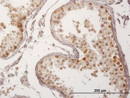 Immunohistochemical analysis of formalin fixed, paraffin embedded Human testis tissue labeling FBXO7 with ab167278 at 3 µg/ml.
