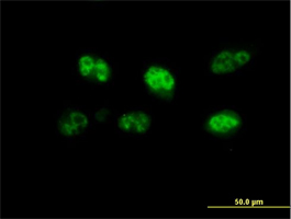 Immunofluorescence analysis of HeLa cells, labeling FBXO7 with ab167278 at 10 µg/ml.