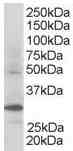 Anti-FbxW2 antibody (ab5309) at 0.3 µg/ml + Human Kidney lysate (RIPA buffer, 30µg total protein per lane). 