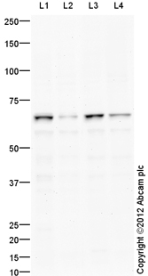 All lanes : Anti-Fbxw7 antibody (ab109617) at 1 µg/mlLane 1 : HepG2 (Human hepatocellular liver carcinoma cell line) Whole Cell LysateLane 2 : HCT 116 (Human Colorectal Carcinoma) Whole Cell LysateLane 3 : PANC-1 (Human Pancreatic Carcinoma) Whole Cell LysateLane 4 : MCF7 (Human breast adenocarcinoma cell line) Whole Cell LysateLysates/proteins at 10 µg per lane.SecondaryGoat Anti-Rabbit IgG H&L (HRP) (ab97051) at 1/10000 dilutiondeveloped using the ECL techniquePerformed under reducing conditions.