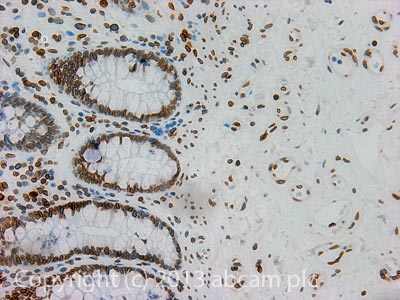 IHC image of Fbxw7 staining in Human normal colon formalin fixed paraffin embedded tissue section, performed on a Leica BondTM system using the standard protocol F. The section was pre-treated using heat mediated antigen retrieval with sodium citrate buffer (pH6, epitope retrieval solution 1) for 20 mins. The section was then incubated with ab109617, 1µg/ml, for 15 mins at room temperature and detected using an HRP conjugated compact polymer system. DAB was used as the chromogen. The section was then counterstained with haematoxylin and mounted with DPX. For other IHC staining systems (automated and non-automated) customers should optimize variable parameters such as antigen retrieval conditions, primary antibody concentration and antibody incubation times.