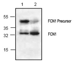 All lanes : Anti-FCN1 antibody (ab70814) at 0.5 µg/mlLane 1 : 3T3 cell lysateLane 2 : Rat kidney tissue lysate