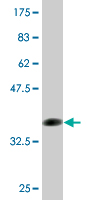 Anti-FCN1 antibody (ab77454) at 1 µg/ml + Recombinant tagged human FCN1 fragment at 0.2 µgSecondaryGoat Anti-Mouse IgG (H&L)-HRP Conjugate at 1/5000 dilution