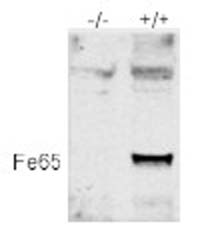 Western blot of Fe65-affinity pulldown materials from mouse brain lysate using ab5668. Lane 1 is an immunopurified sample from a full-length Fe65 Knockout mouse. Lane 2 is an immunopurified sample from an Fe65 wild type mouse.