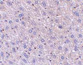 ab3686 at 5µg/ml staining of FEM 1B in mouse liver tissue by IHC