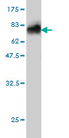 Western blot against tagged recombinant protein immunogen using ab54748 Fetuin antibody at 1ug/ml.