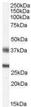 Anti-FGF 23 antibody (ab56326) at 0.5 µg/ml + Human Brain (Hippocampus) lysate (35µg protein in RIPA buffer)