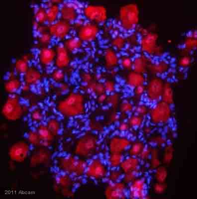 ab9588 staining FGF1 in rat dorsal root ganglia tissue by Immunohistochemistry (Frozen sections).Tissue was fixed in paraformaldehyde and permeabilized using 0.25% Triton X-100. Samples were then blocked 0.25% BSA for 1 hour at 25°C, then incubated with ab9588 at a 1/200 dilution for 16 hours at 4°C. The secondary used was a donkey anti-rabbit polyclonal conjugated to rhodamine, 1/500 dilution.See Abreview