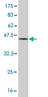 Western blot against tagged recombinant protein immunogen using ab58311 FGF1 antibody at 1ug/ml.