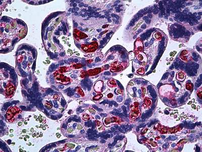 Human Placenta, Formalin-Fixed, Paraffin-Embedded tissue, stained with ab117640 at 5µg/ml.