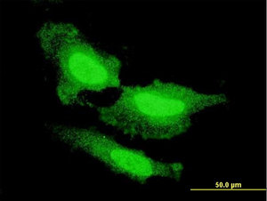 Immunofluorescence analysis of FGF1 expression on HeLa cells with ab117640 at 10µg/ml.