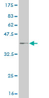 Western blot against tagged recombinant protein immunogen using ab54589 CPT2 antibody at 1ug/ml.