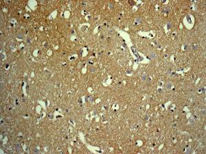 Immunohistochemical analysis of formalin-fixed, paraffin-embedded, Human brain tissue labeling FGF1 with ab179455 at a 1/100 dilution.