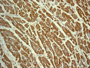 Immunohistochemical analysis of formalin-fixed, paraffin-embedded, Human heart tissue labeling FGF1 with ab179455 at a 1/100 dilution.