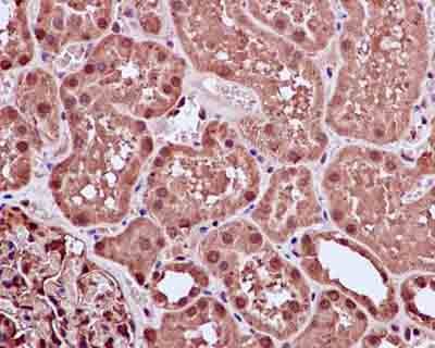 Immunohistochemical analysis of paraffin-embedded Human kidney tissue labeling FGF1 with ab183494 at 1/100 dilution, followed by prediluted HRP Polymer for Rabbit IgG. Counter stained with Hematoxylin.