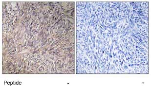 Immunohistochemistry analysis of FGF22 in paraffin-embedded human ovary tissue using ab74860, at 1/50 dilution, in the presence (right panel) or absence (left panel) of immunising peptide.