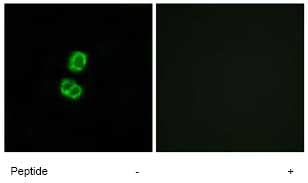 Immunofluorescence analysis of FGF22 in MCF-7 cells using ab74860, at 1/500 dilution, in the presence (right panel) or absence (left panel) of immunising peptide.